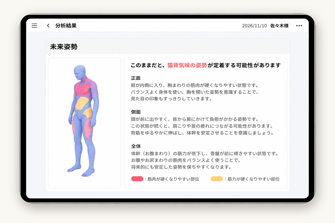 姿勢分析からわかる身体の状態の例