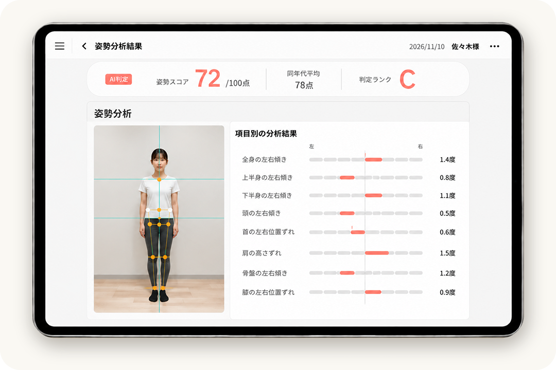 シセイカルテによる正面からの姿勢分析の例