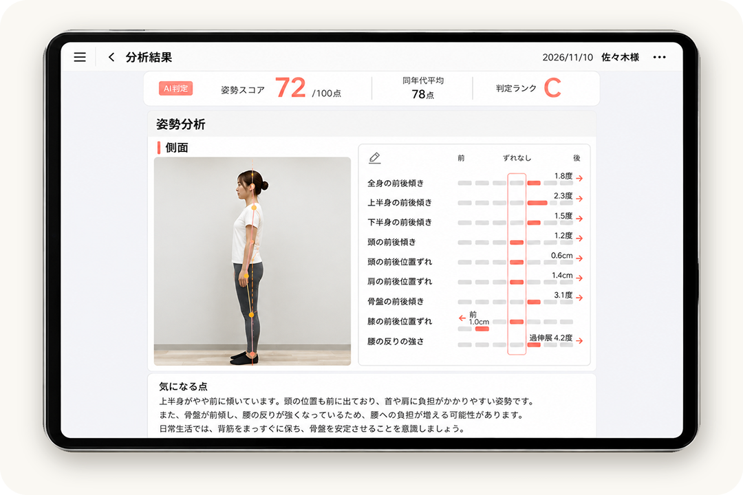 シセイカルテによる横からの姿勢分析の例